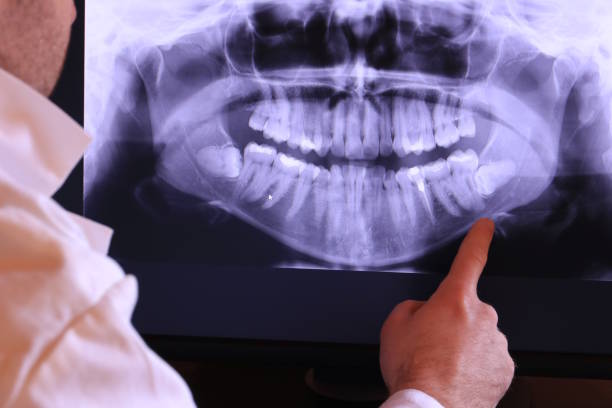 Best Emergency Gum Treatment in Olivarez, TX